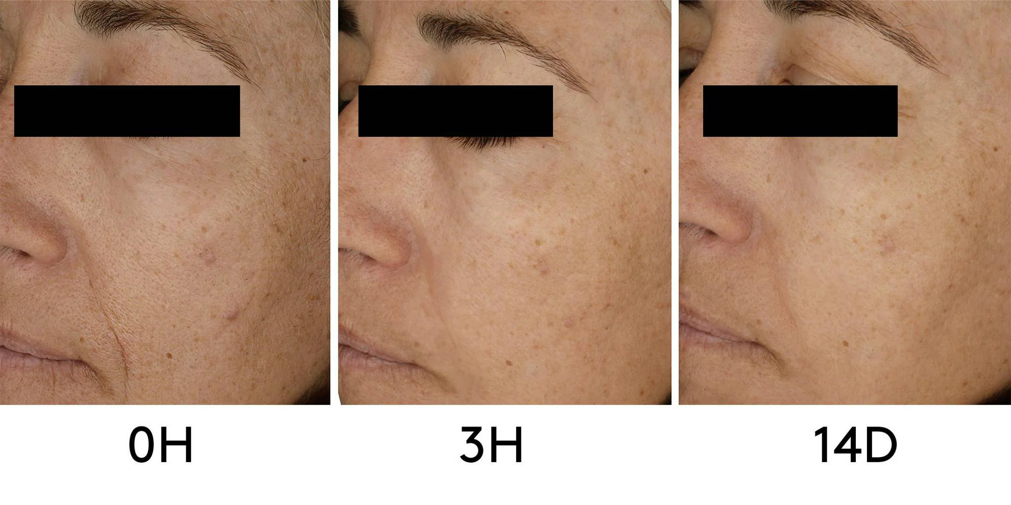 CLINICAL BEAUTY FILLER